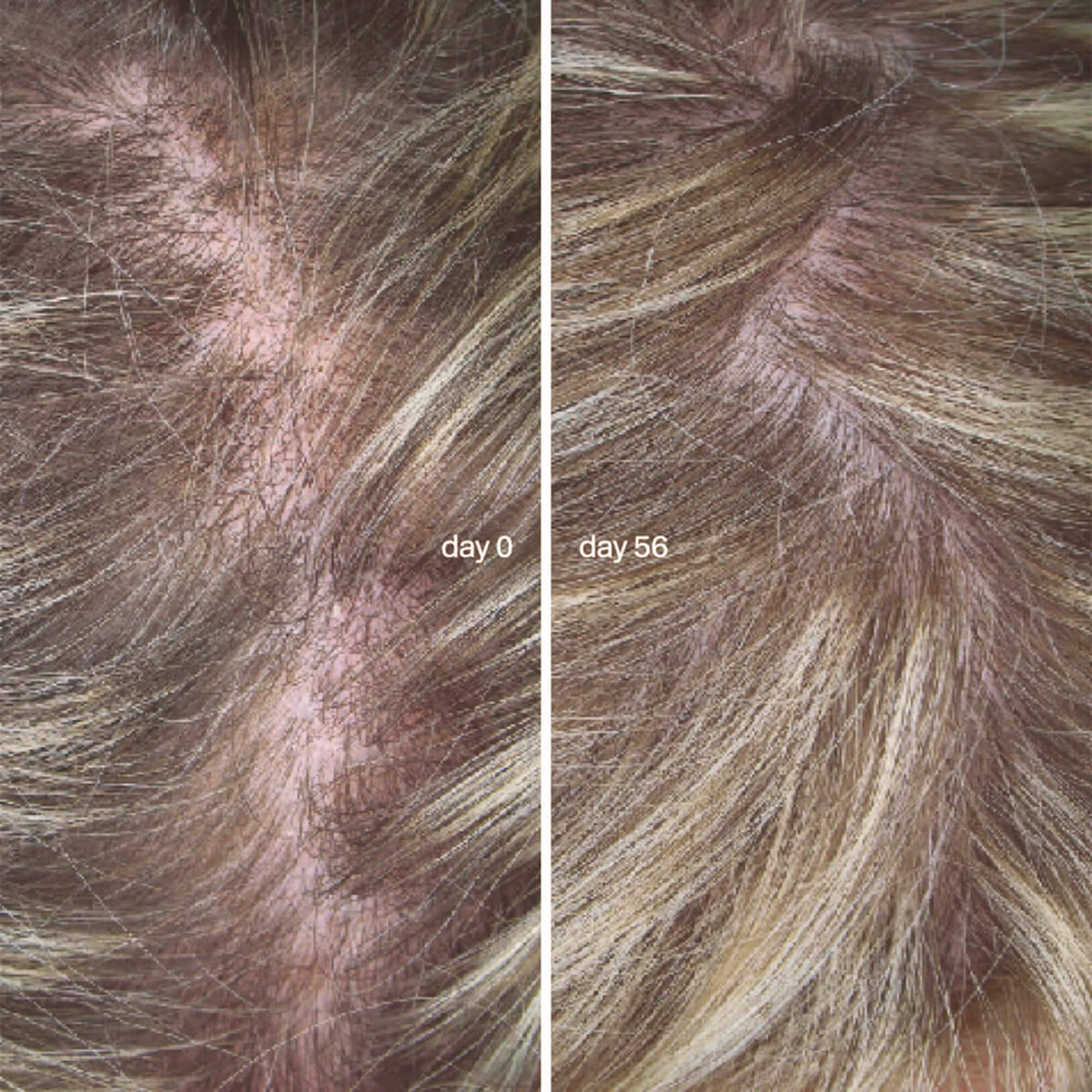 L'Essentiel Cheveux 3-month treatment - Image 5